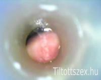 Videó egy endoszkópos pénisz belsejéből készült