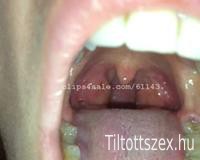 száj, szájfétis, vore, belső száj, fogak, torok, nyelv